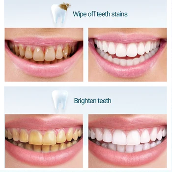 BAIMISS Pluma para Blanquear los Dientes Pasta de dientes Cepillo de dientes de Suero de Limpieza Dental Herramientas Esencia de Gel de Higiene Oral Eliminar la Placa de las Manchas de 5ml